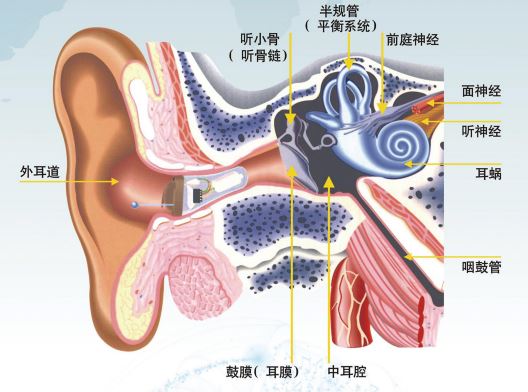 世界卫生组织(WHO 2021)听力障碍分级标准及日常表现